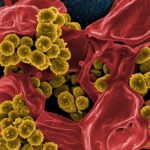 post-nasal drip and bad breath halitosis