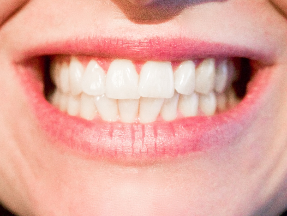can a night guard shift your teeth